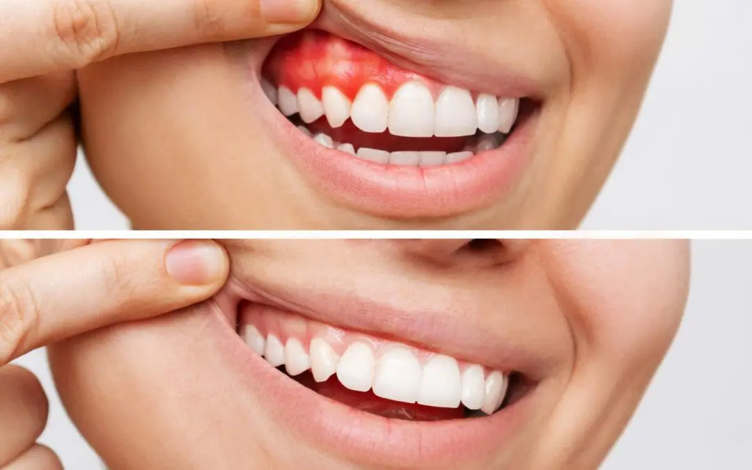 shutterstock_2125599860 1080x675 1